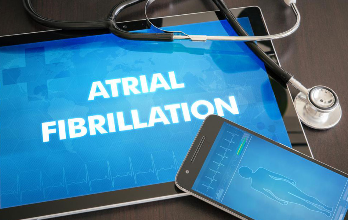 All You Need To Know About Atrial Fibrillation